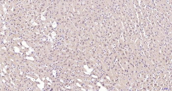 Phospho-Akt (Thr450) Recombinant Rabbit Monoclonal Antibody