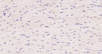 Phospho-Akt (Thr450) Recombinant Rabbit Monoclonal Antibody