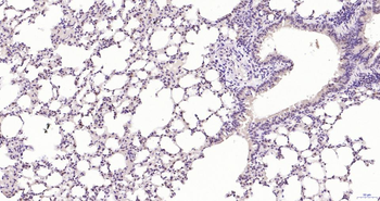 Phospho-Akt (Thr450) Recombinant Rabbit Monoclonal Antibody