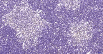 Phospho-Akt (Thr450) Recombinant Rabbit Monoclonal Antibody