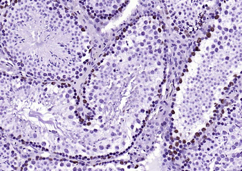 HDAC2 Recombinant Rabbit Monoclonal Antibody