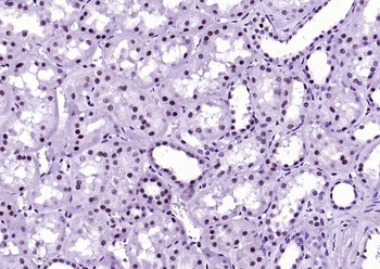 HDAC2 Recombinant Rabbit Monoclonal Antibody