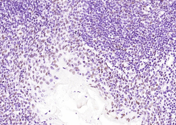HDAC2 Recombinant Rabbit Monoclonal Antibody