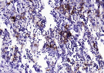 CK7 Recombinant Rabbit Monoclonal Antibody