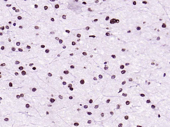 Cdk4 Mouse Monoclonal Antibody