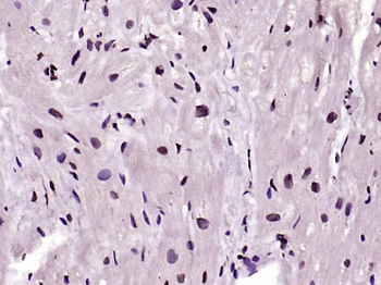 Cdk4 Mouse Monoclonal Antibody