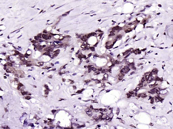 Cdk4 Mouse Monoclonal Antibody