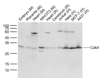 Cdk4 Mouse Monoclonal Antibody