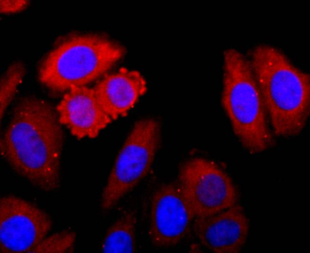 CDK1 Recombinant Rabbit Monoclonal Antibody