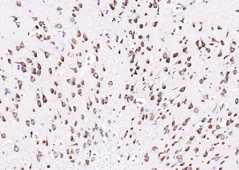 RPS6 (N-term) Mouse Monoclonal Antibody