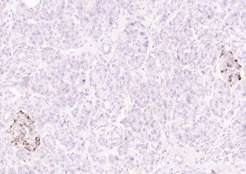 CD151 Rabbit Polyclonal Antibody