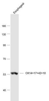 CK14+17+42+10 antibody