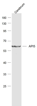 API5 Rabbit Polyclonal Antibody