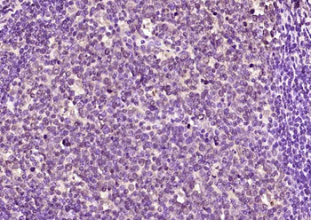 P45 NF-E2 Rabbit Polyclonal Antibody