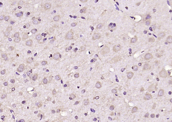 DOK1 Rabbit Polyclonal Antibody