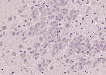 EDG8 Rabbit Polyclonal Antibody