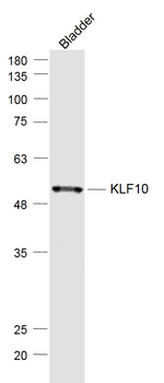 KLF10 Rabbit Polyclonal Antibody