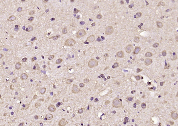 CD2AP Rabbit Polyclonal Antibody