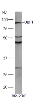 UBF1 Rabbit Polyclonal Antibody