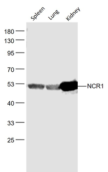 NCR1 Rabbit Polyclonal Antibody