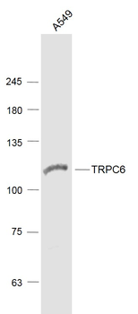 TRPC6 Rabbit Polyclonal Antibody