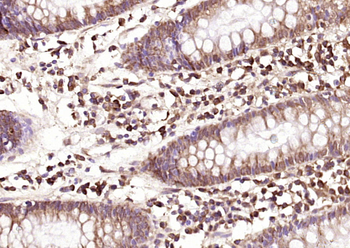 CEAcam8 Rabbit Polyclonal Antibody