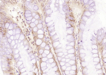 Rb Rabbit Polyclonal Antibody