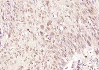 Rb Rabbit Polyclonal Antibody