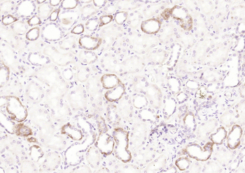 Clathrin heavy chain Rabbit Polyclonal Antibody