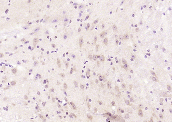 Clathrin heavy chain Rabbit Polyclonal Antibody