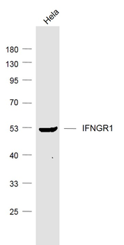 IFNGR1 Rabbit Polyclonal Antibody