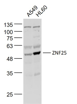 ZNF25 Rabbit Polyclonal Antibody