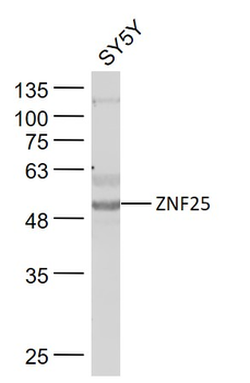 ZNF25 Rabbit Polyclonal Antibody