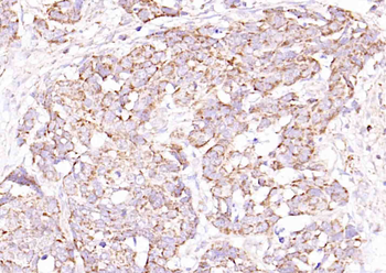 ULBP1 Rabbit Polyclonal Antibody