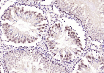 BNC1 Rabbit Polyclonal Antibody