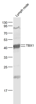 TBX1 Rabbit Polyclonal Antibody
