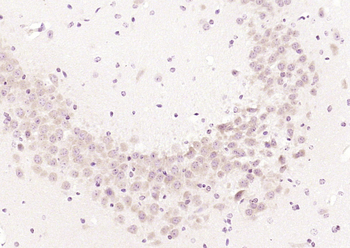 CHRNB2 Rabbit Polyclonal Antibody