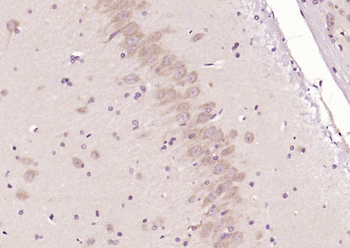 LAMP2 Rabbit Polyclonal Antibody