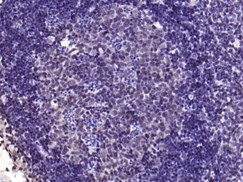 Phospho-YB1 (Ser102) Rabbit Polyclonal Antibody