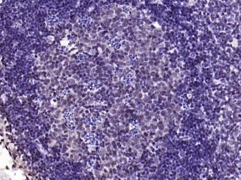 YB1 (phospho-Ser102) antibody