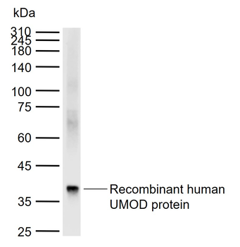 UMOD Rabbit Polyclonal Antibody