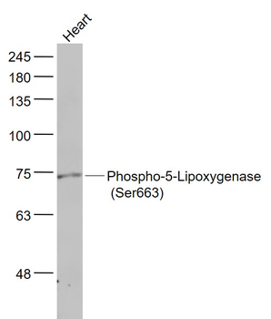 Phospho-ALOX5 (Ser663) Rabbit Polyclonal Antibody