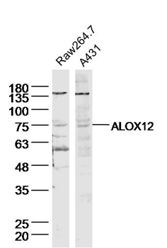 ALOX12 Rabbit Polyclonal Antibody