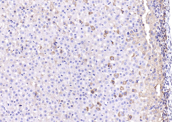 ACADVL Rabbit Polyclonal Antibody