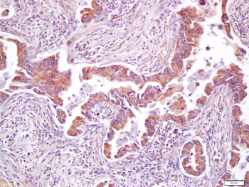 AMPK beta 2 Rabbit Polyclonal Antibody