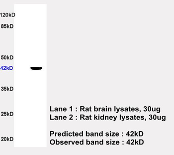 APOA4 Rabbit Polyclonal Antibody