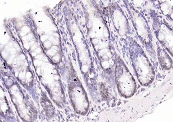 AKR1D1 Rabbit Polyclonal Antibody