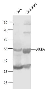 ARSA Rabbit Polyclonal Antibody