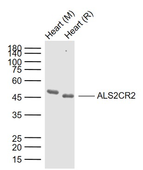 ALS2CR2 Rabbit Polyclonal Antibody