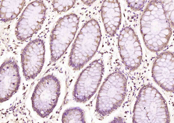 Phospho-ATF2 (Thr69/71) Rabbit Polyclonal Antibody